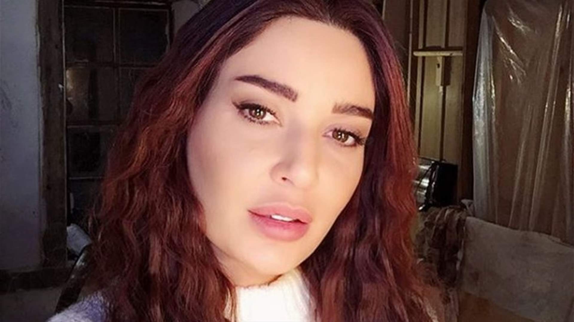 بالصورة: آثار الكدمات على وجه سيرين عبدالنور.. "مين عمل فيها هيك"؟