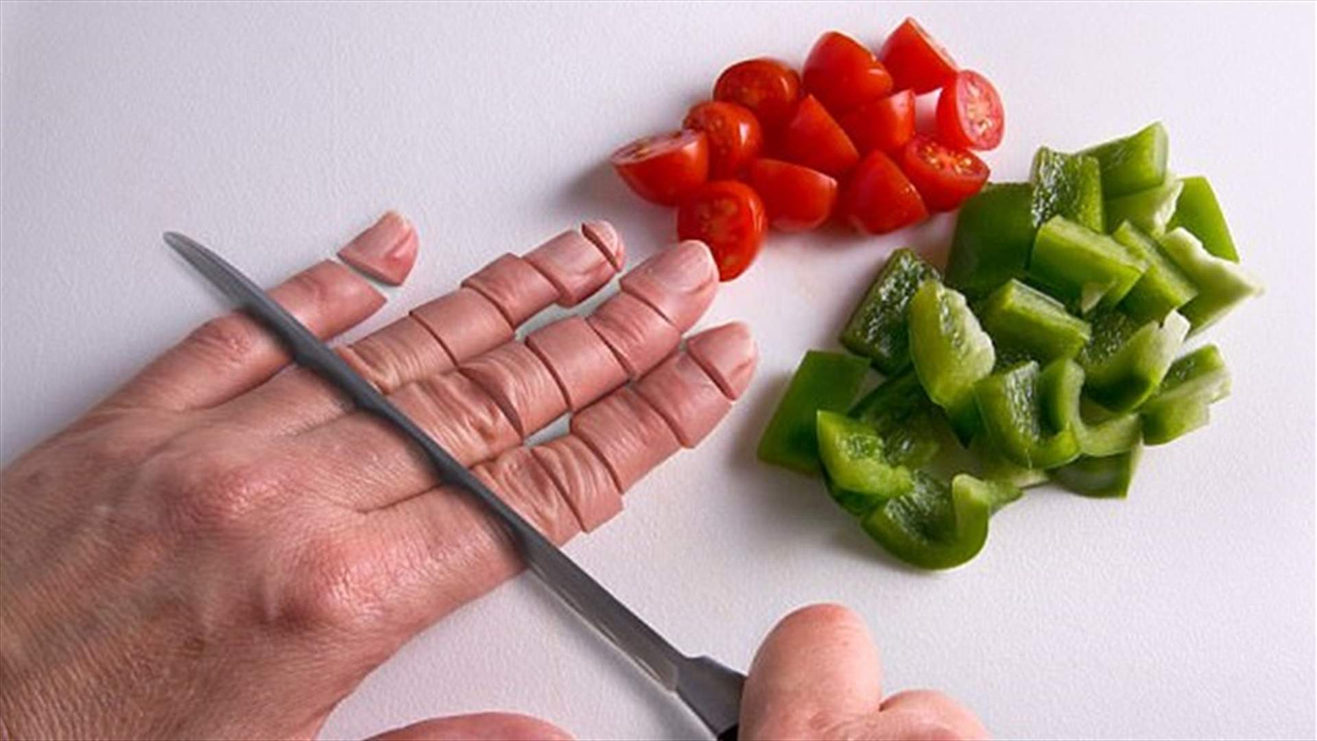 ما هي الخطوات التي يجب اتباعها في حال بتر أصابع اليد؟