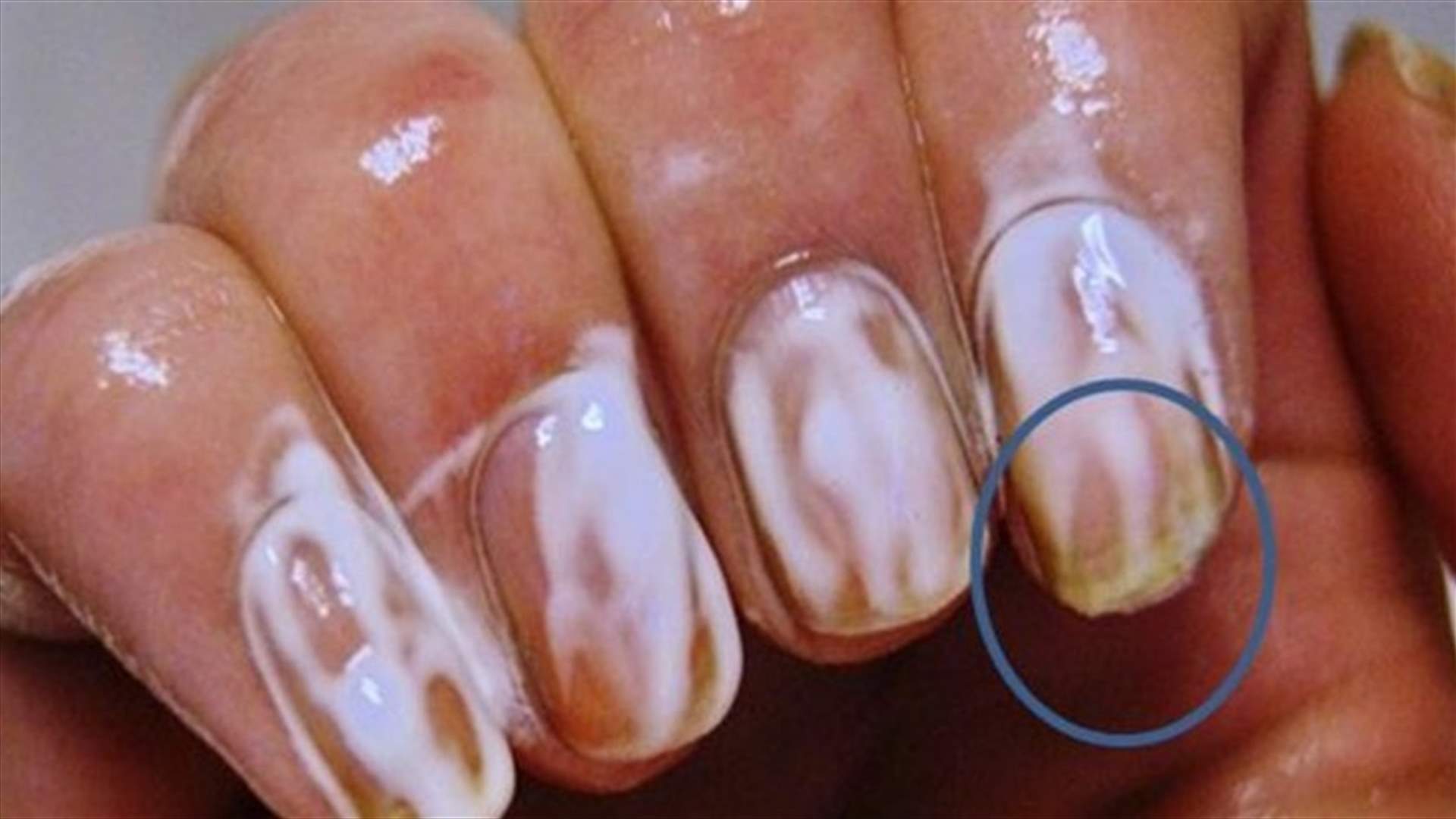 ماذا يحصل عند فرك الأظافر بصودا الخبز؟