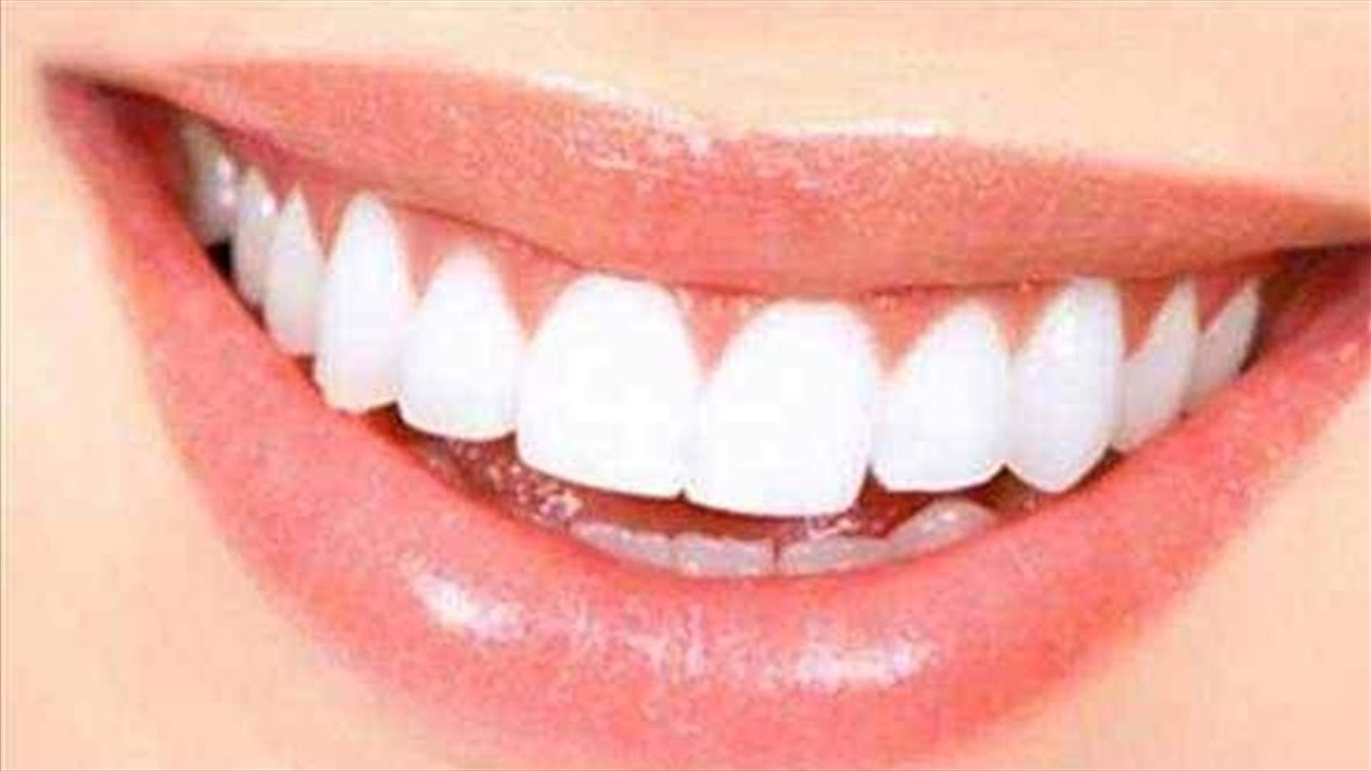 بالفيديو: مكوّنان أساسيان... سرّ ابتسامة ناصعة البياض!