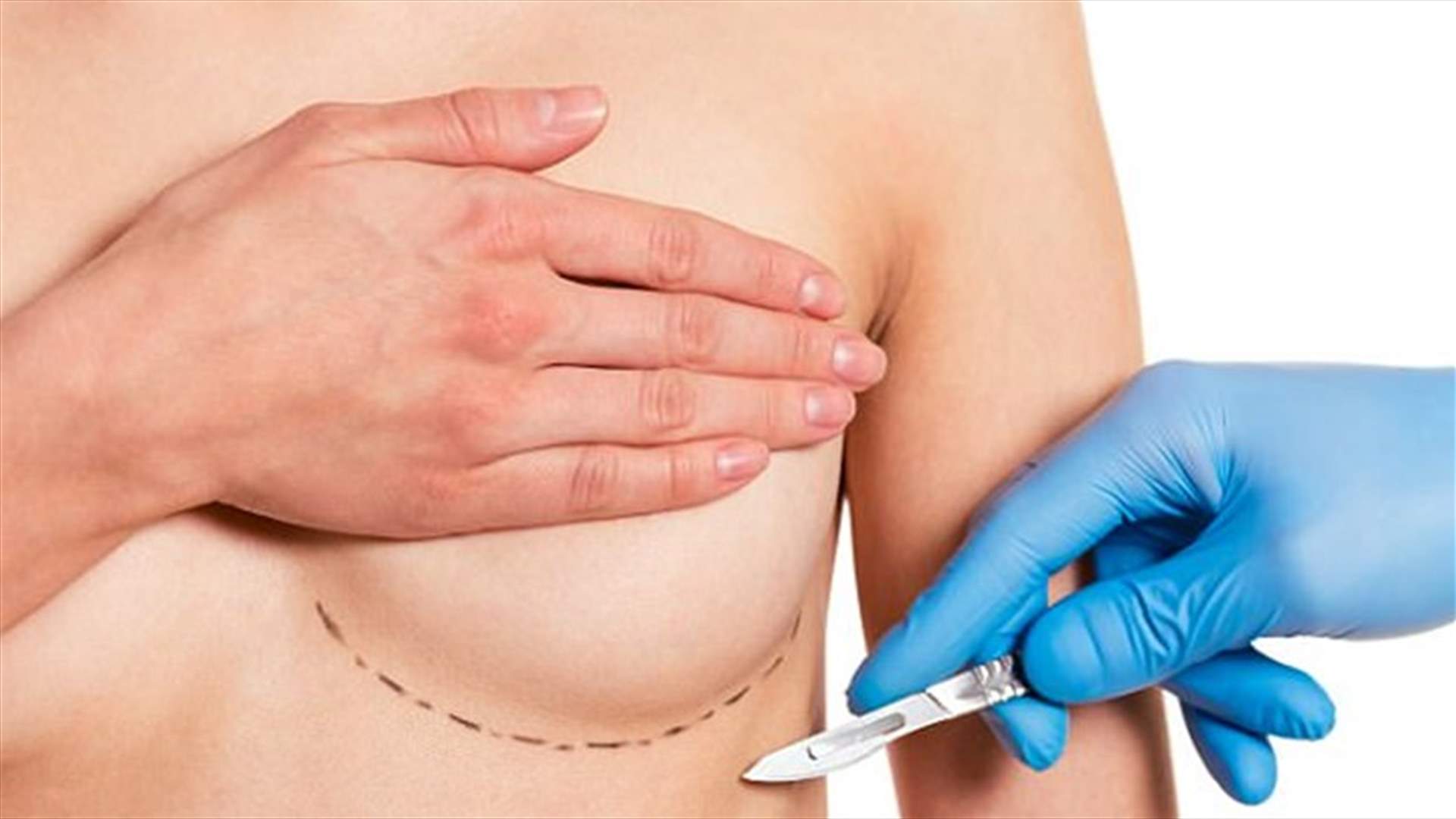 زراعة الثدي تؤدي إلى تشخيص خاطئ للنوبة القلبية!