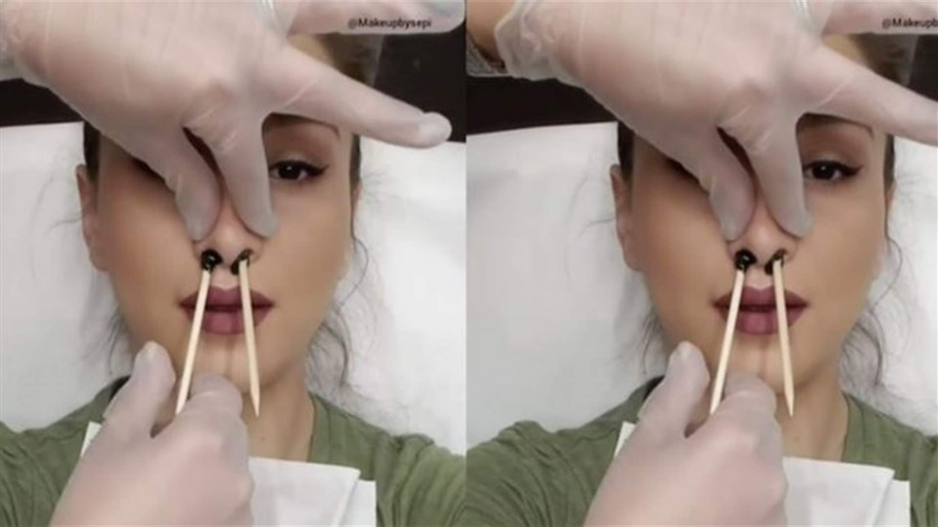 فيديو لشابة تزيل شعر أنفها بالشمع يجتاح الانترنت... ما المخاطر الصحية لهذه الخطوة؟