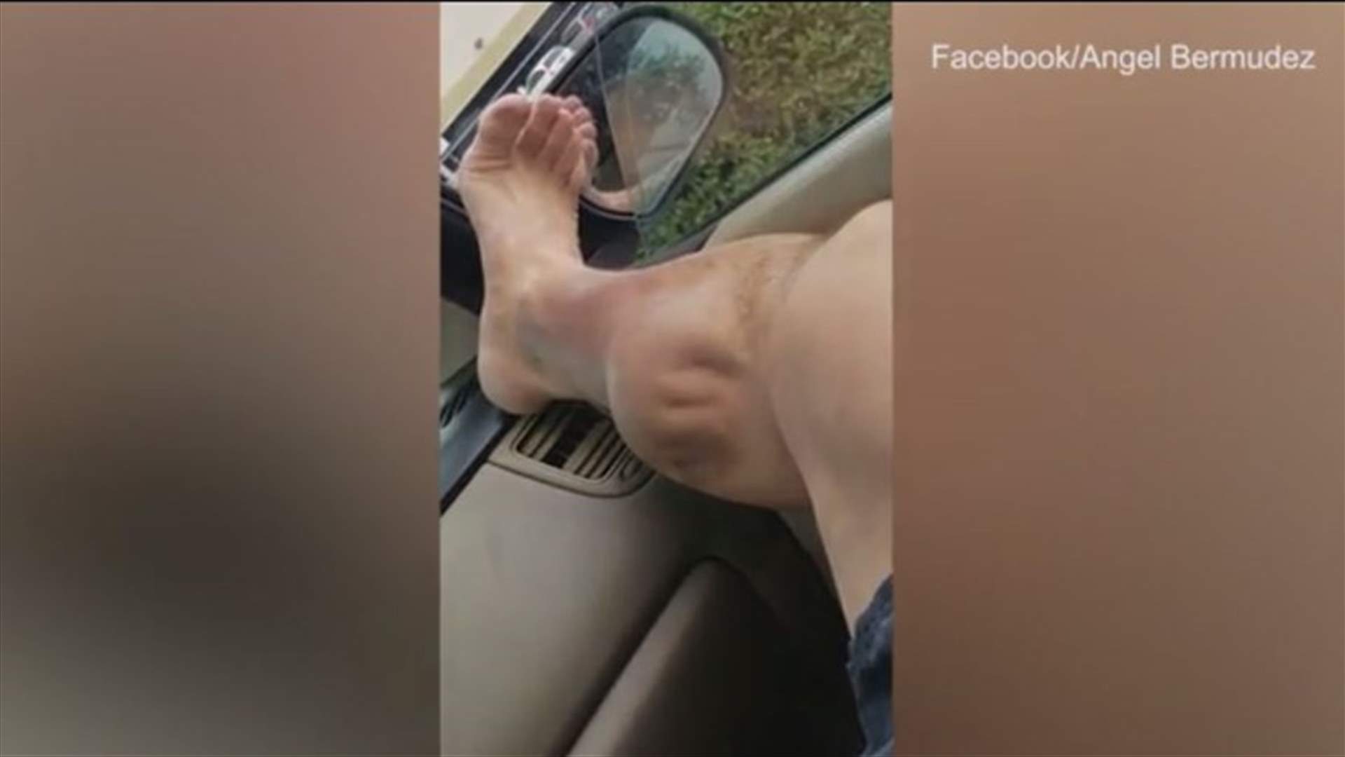 فيديو يحصد 9 ملايين مشاهدة لرجل أصيب بتشنّج غريب في ساقه!