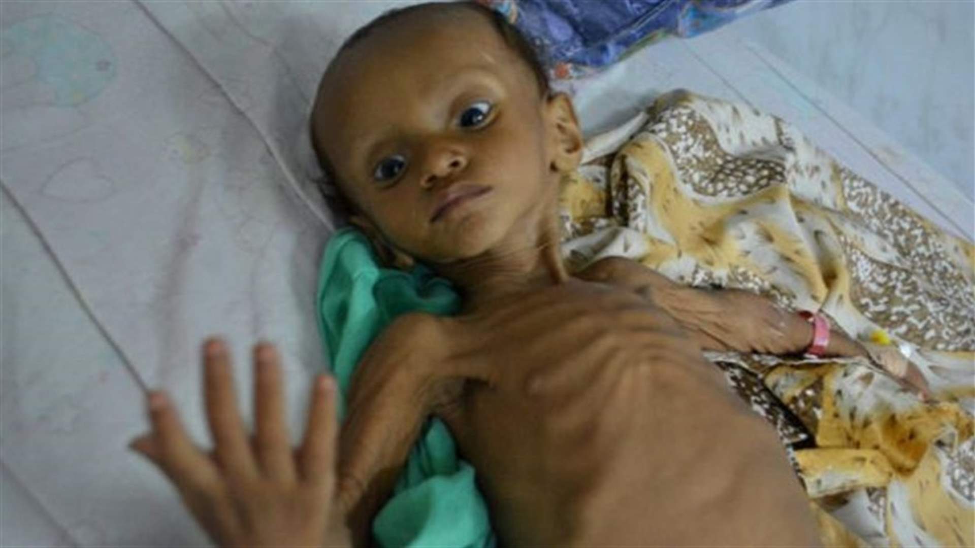 Yemen's cholera epidemic hits 600,000, confounding expectations