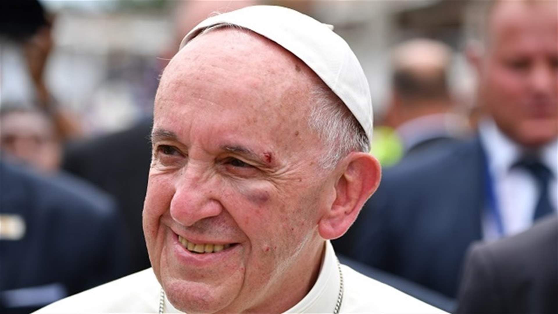 بالفيديو- تعرّض البابا فرنسيس للإصابة في عينه بعد توقّف السيارة المفاجئ