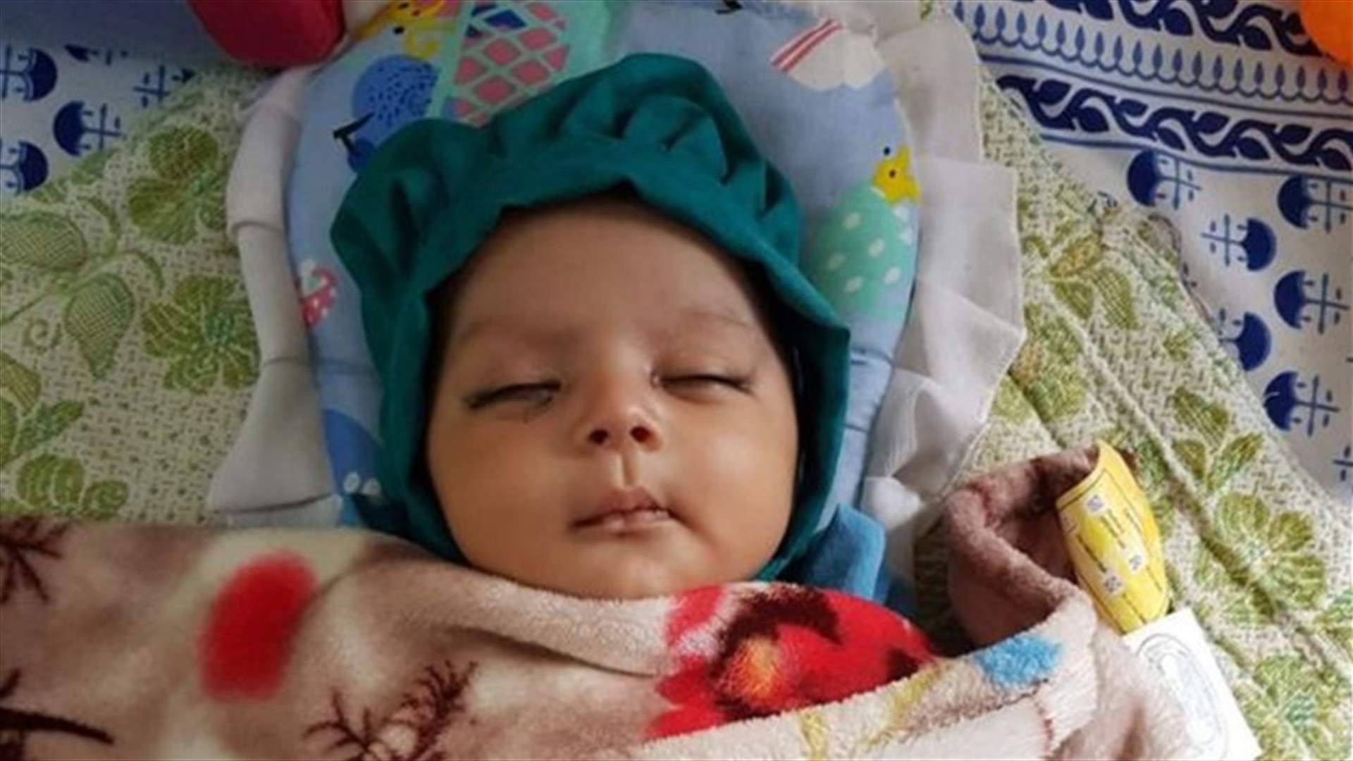 بالصورة - اقتلاع سبعة أسنان من فم رضيع عمره شهر!