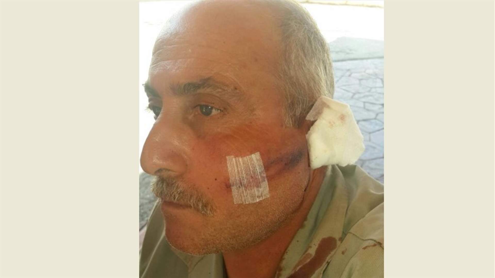 بالصورة- تعرض ناطور اراضي بلدة عيتنيت للضرب من قبل مجهولين