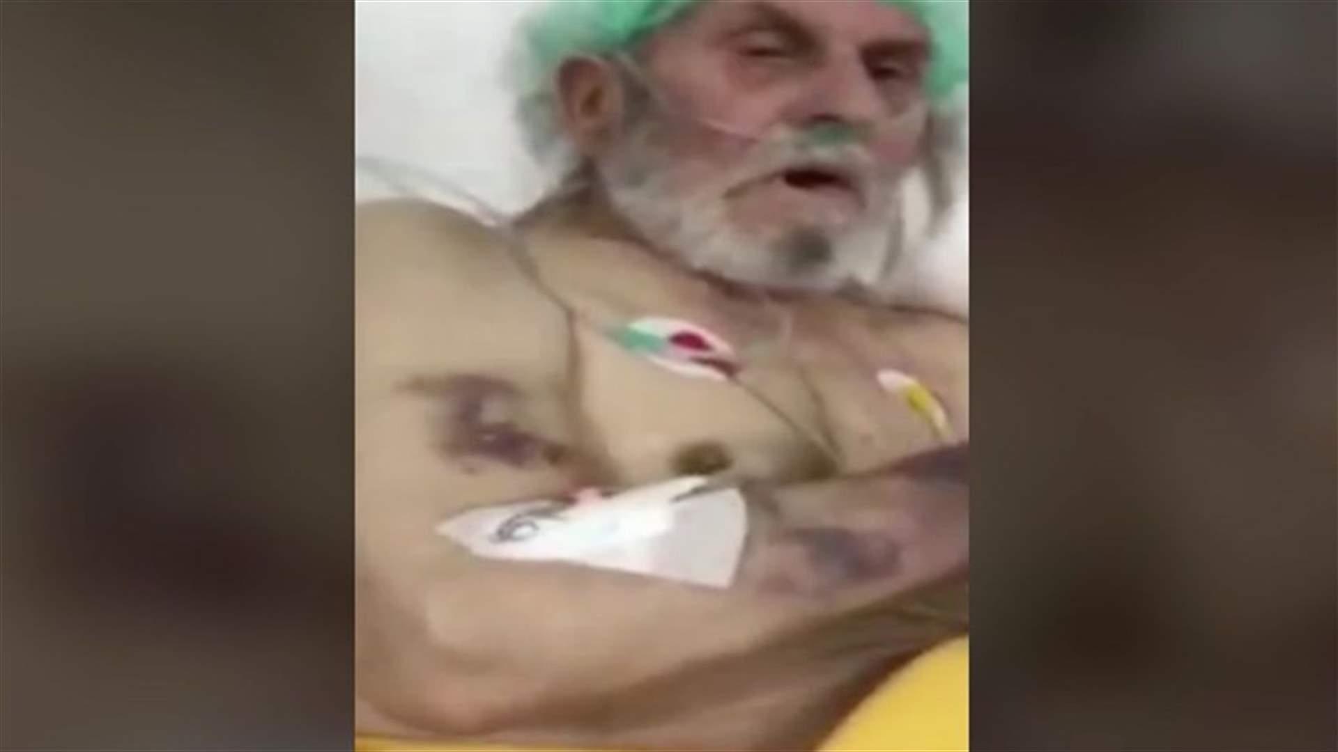 ممرضات أعطين سيجارة لمريض مسن...فيديو صادم!