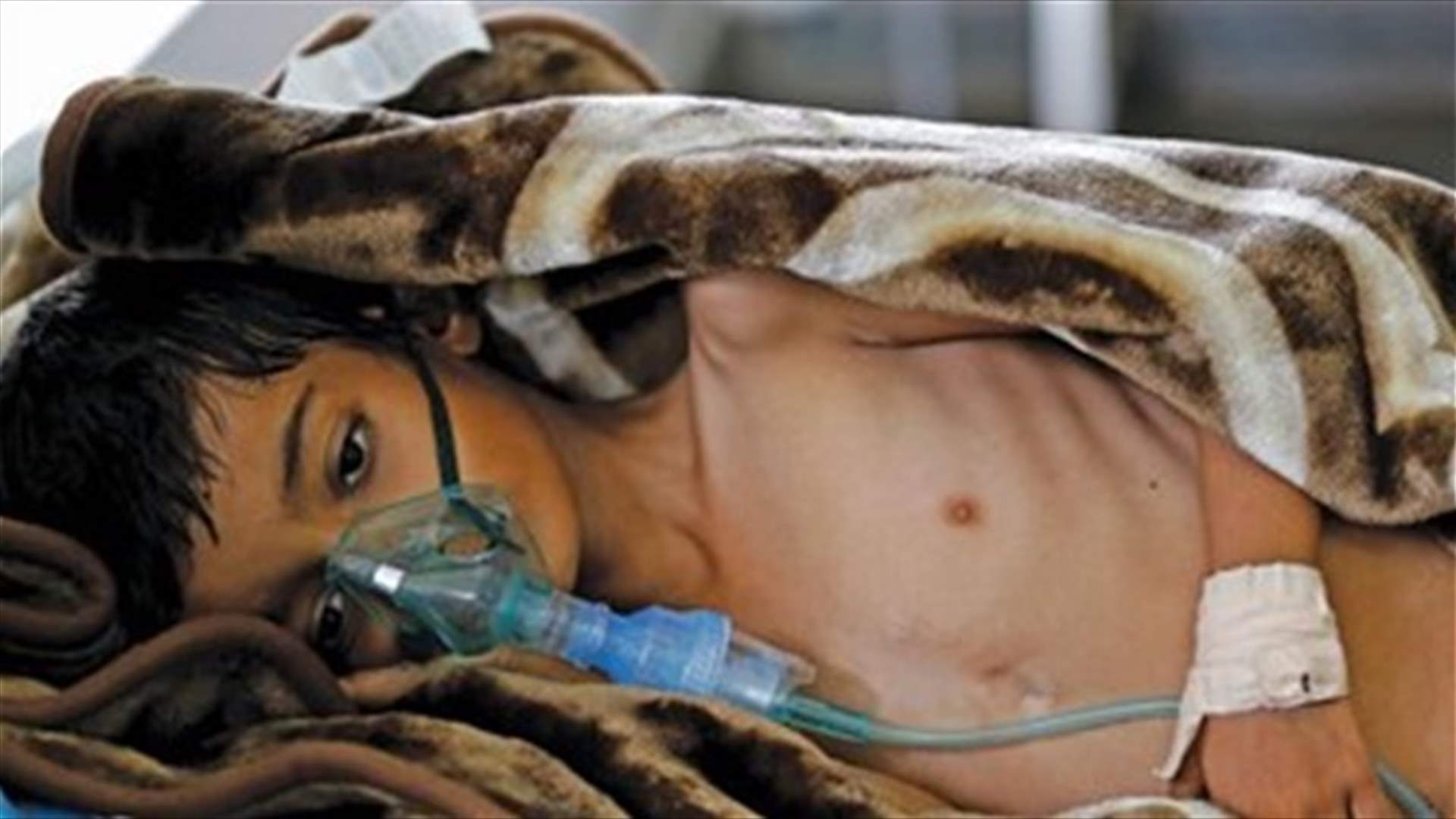 Yemen cholera cases could hit 1 million by year-end - Red Cross