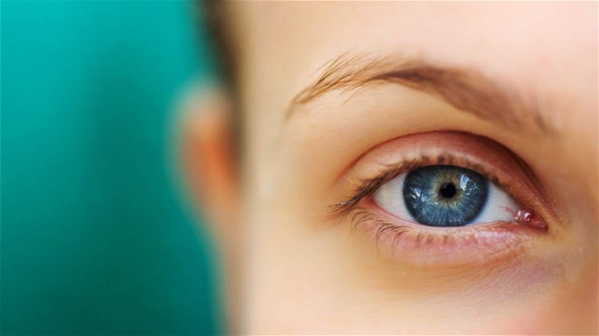 كيف تتخلصون من بثور الجفن؟