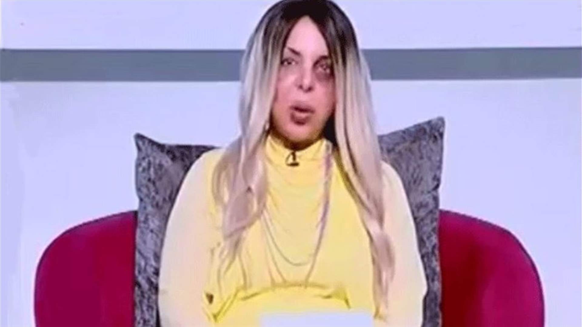بالفيديو - مذيعة مصرية تطل على المشاهدين بكدمات على وجهها... ما القصّة؟