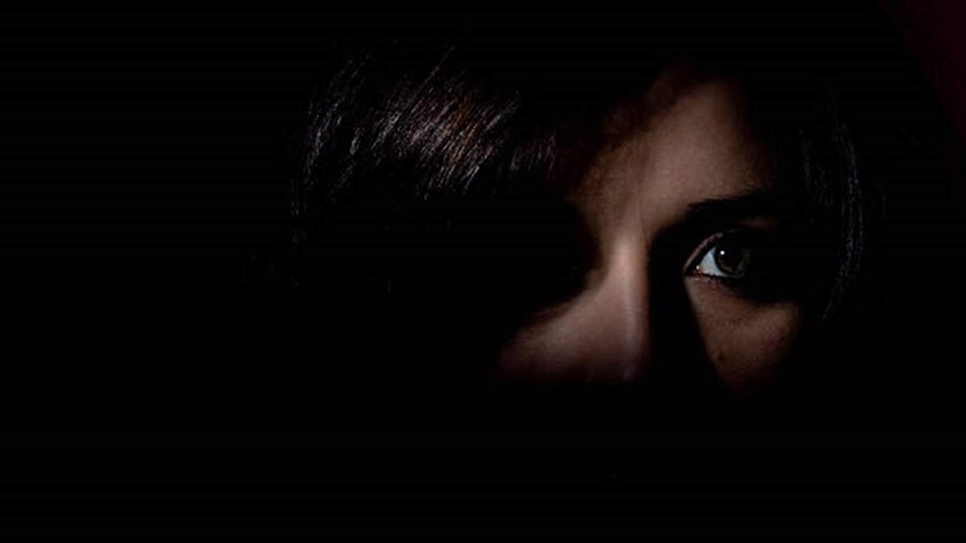 فتاة انعزلت عن العالم بسبب تورّم في وجهها... إليكم حالتها
