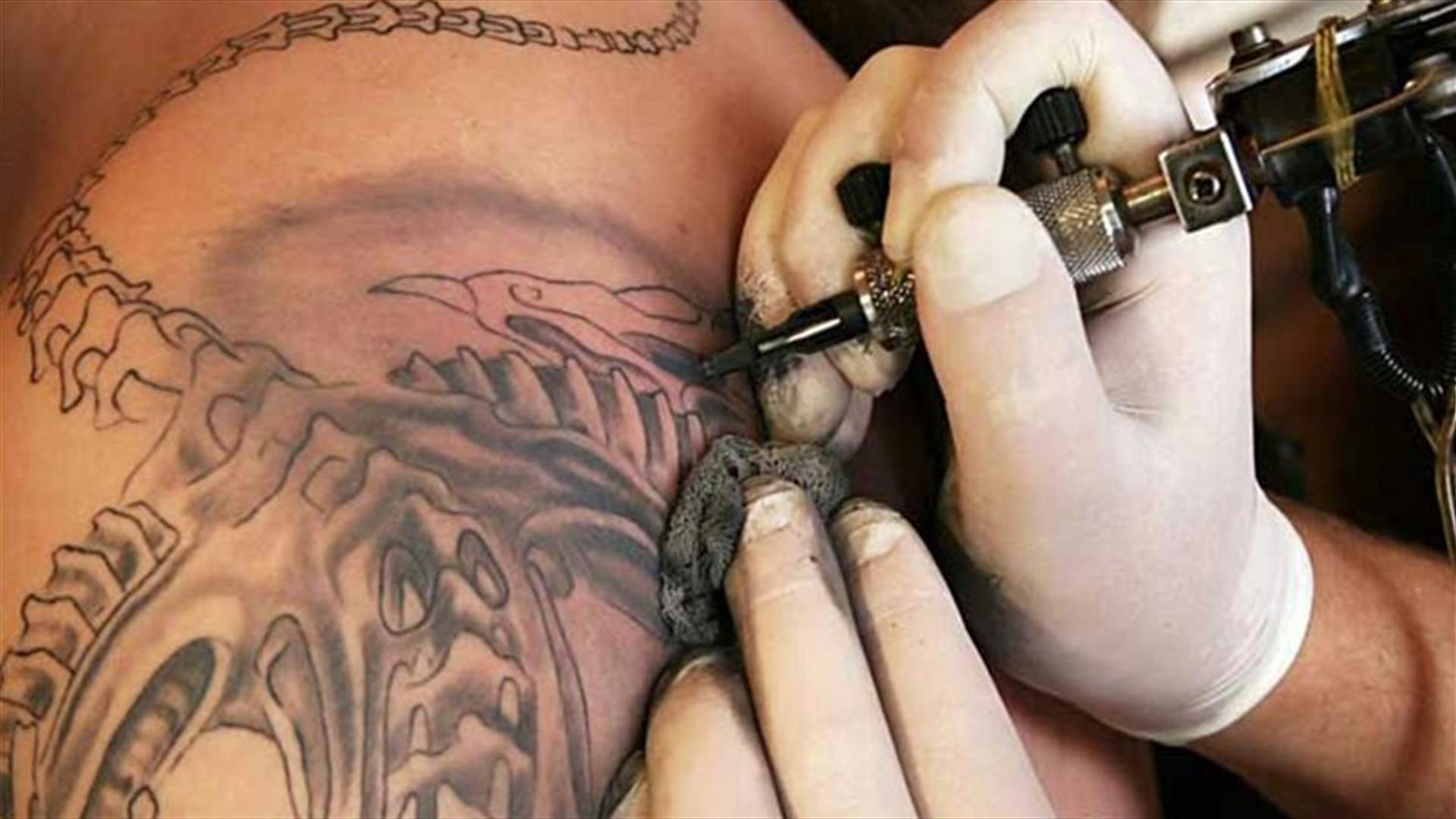 تقنية جديدة لازالة الوشم بعد ارتفاع عدد الاخطاء