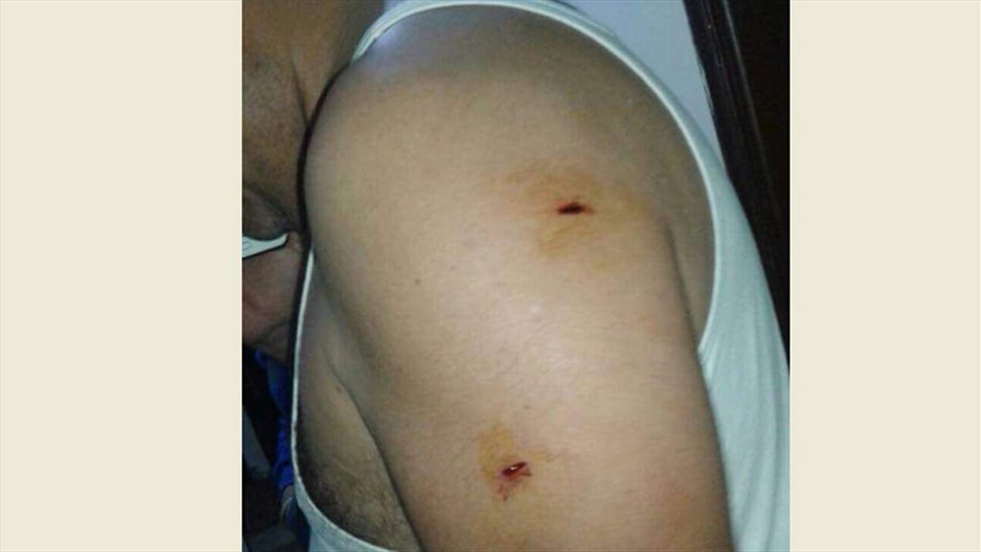 اطلاق النار على شقيق متورط في أحداث صيدا
