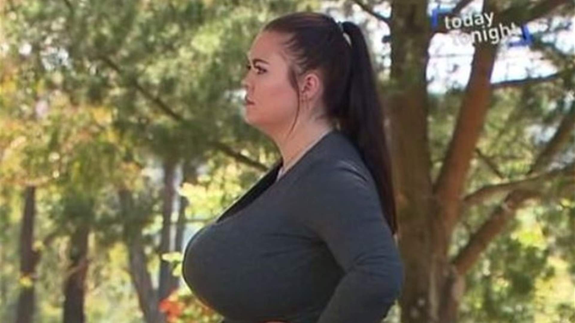 ناشدت الغرباء لمساعدتها في دفع تكاليف جراحة تصغير الثدي...ما قصة هذه السيدة؟