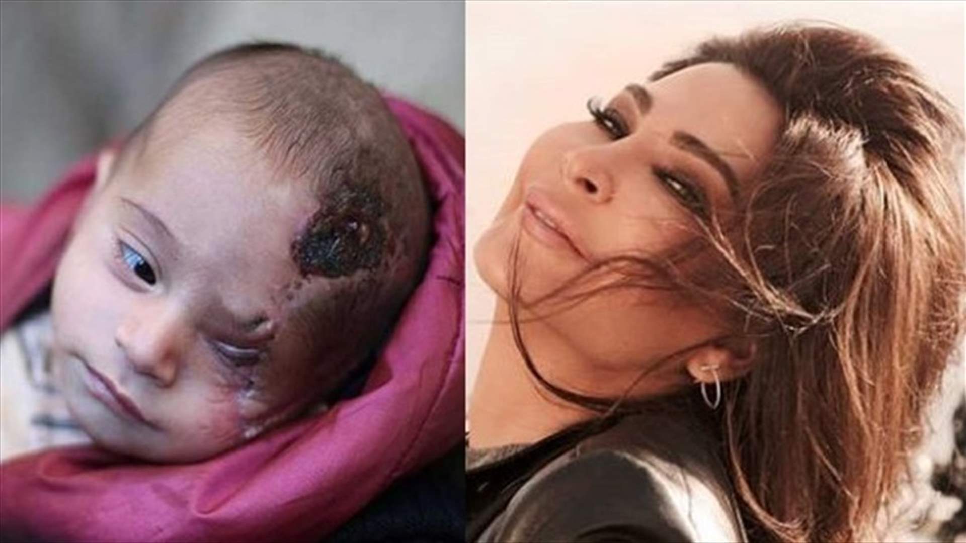 بالصورة: لفتة إنسانيّة من إليسا إلى الطفل كريم الّذي فقد عينه