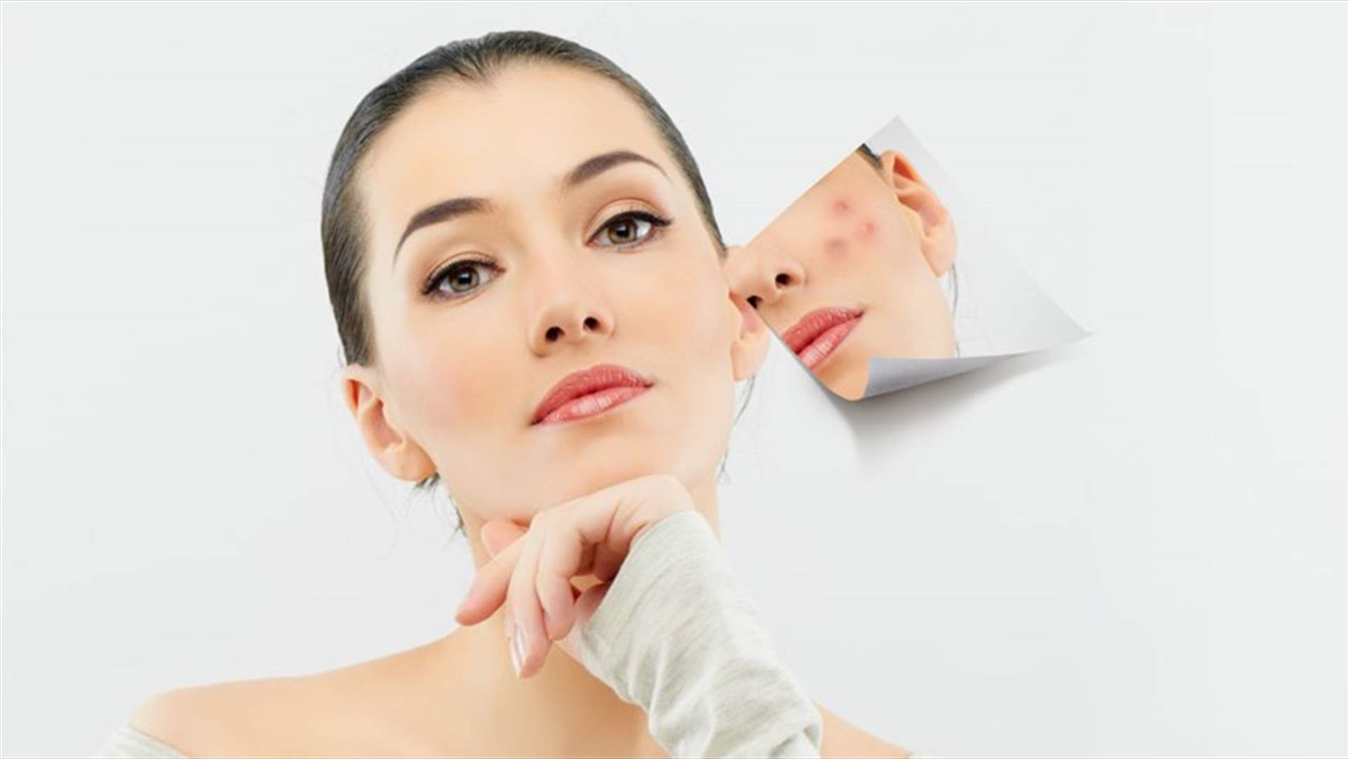 زيت مستخرج من نبات استوائي يعالج حبّ الشباب بطريقة سحرية!