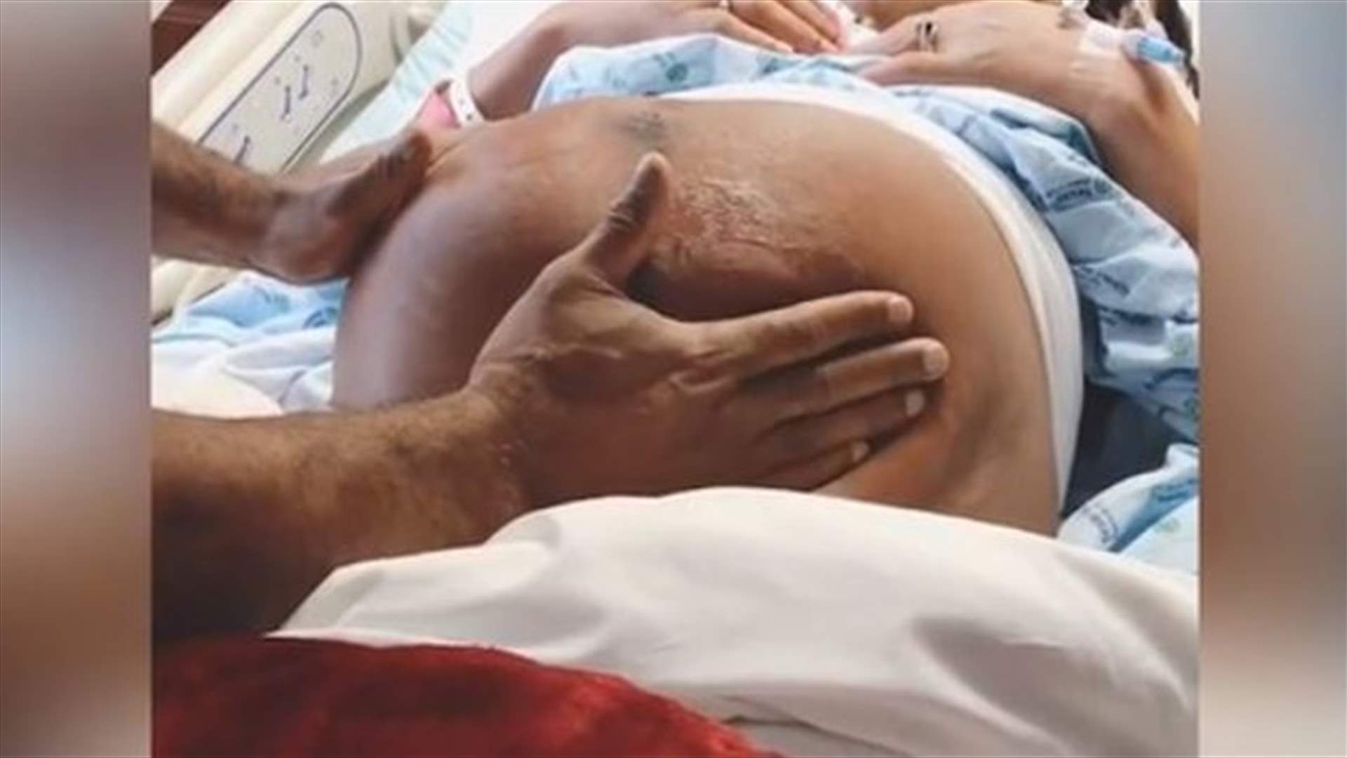 بالفيديو – طبيب يُغيّر وضعية جنين داخل رحم أمه