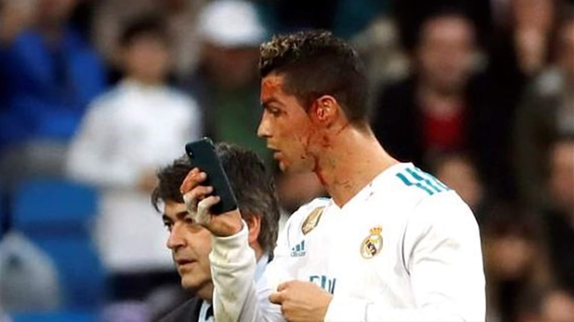 رونالدو يتعرّض لإصابة في رأسه ويستخدم هاتف الطبيب للتحقّق منها