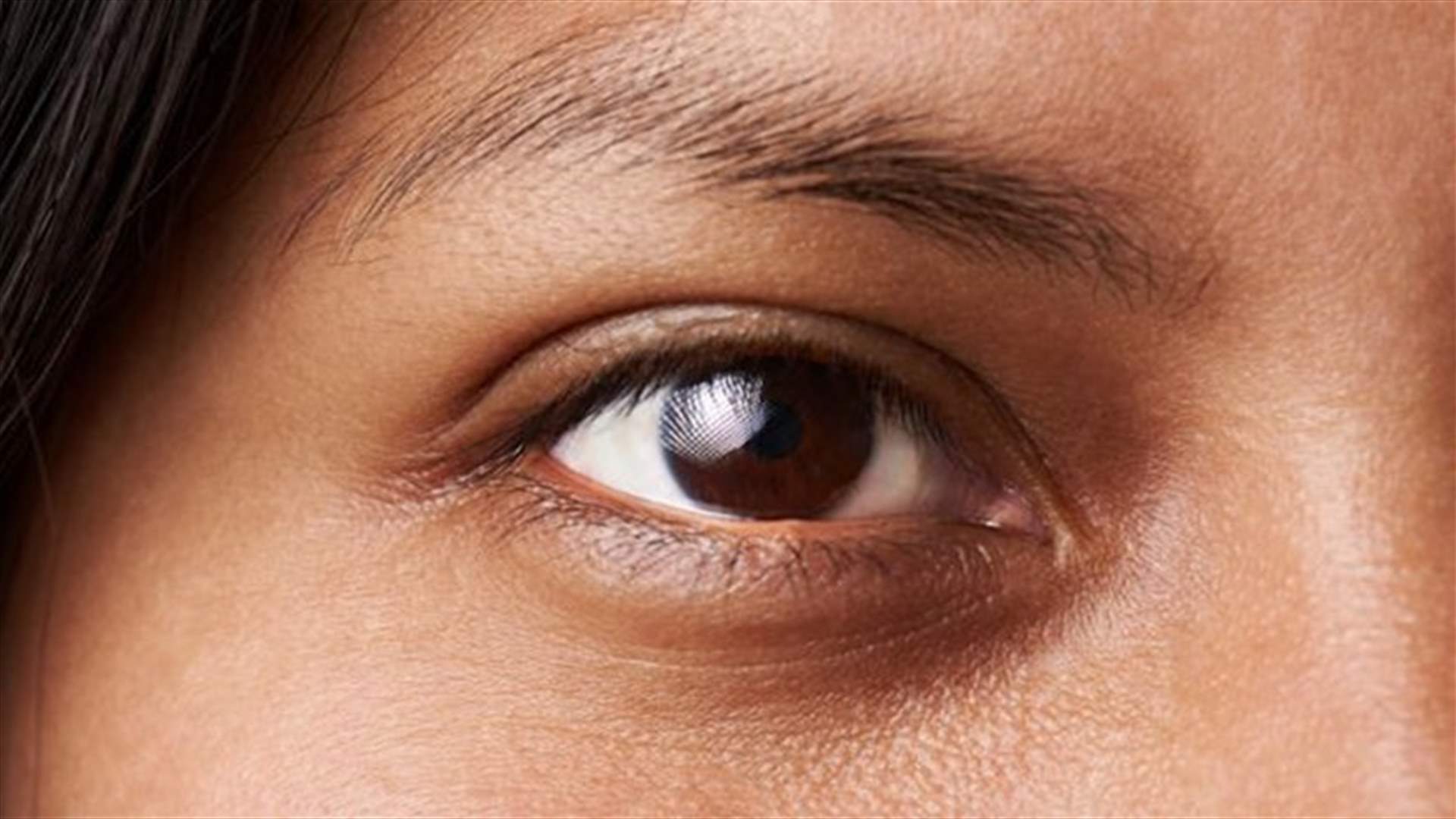 الهالات السوداء حول العينين قد تكشف عن الإصابة بهذه المشكلة الصحية...