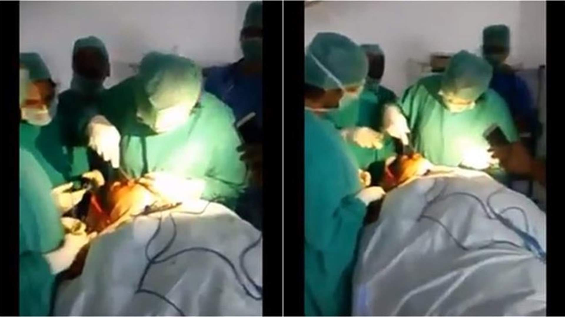 بالفيديو- أطباء يجرون عملية جراحية على ضوء الهاتف... ماذا حصل؟