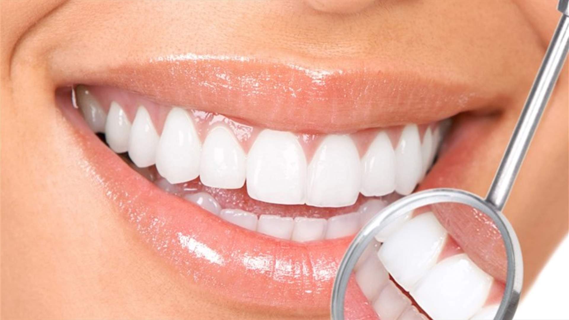 علاجات طبيعية للتخلّص من تجاويف الأسنان