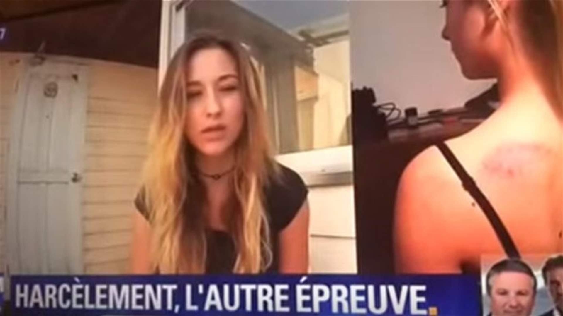 بالفيديو- في قضية إغتصابها من قبل نجم عربي.. الضحية تكشف عن آثار الإعتداء!