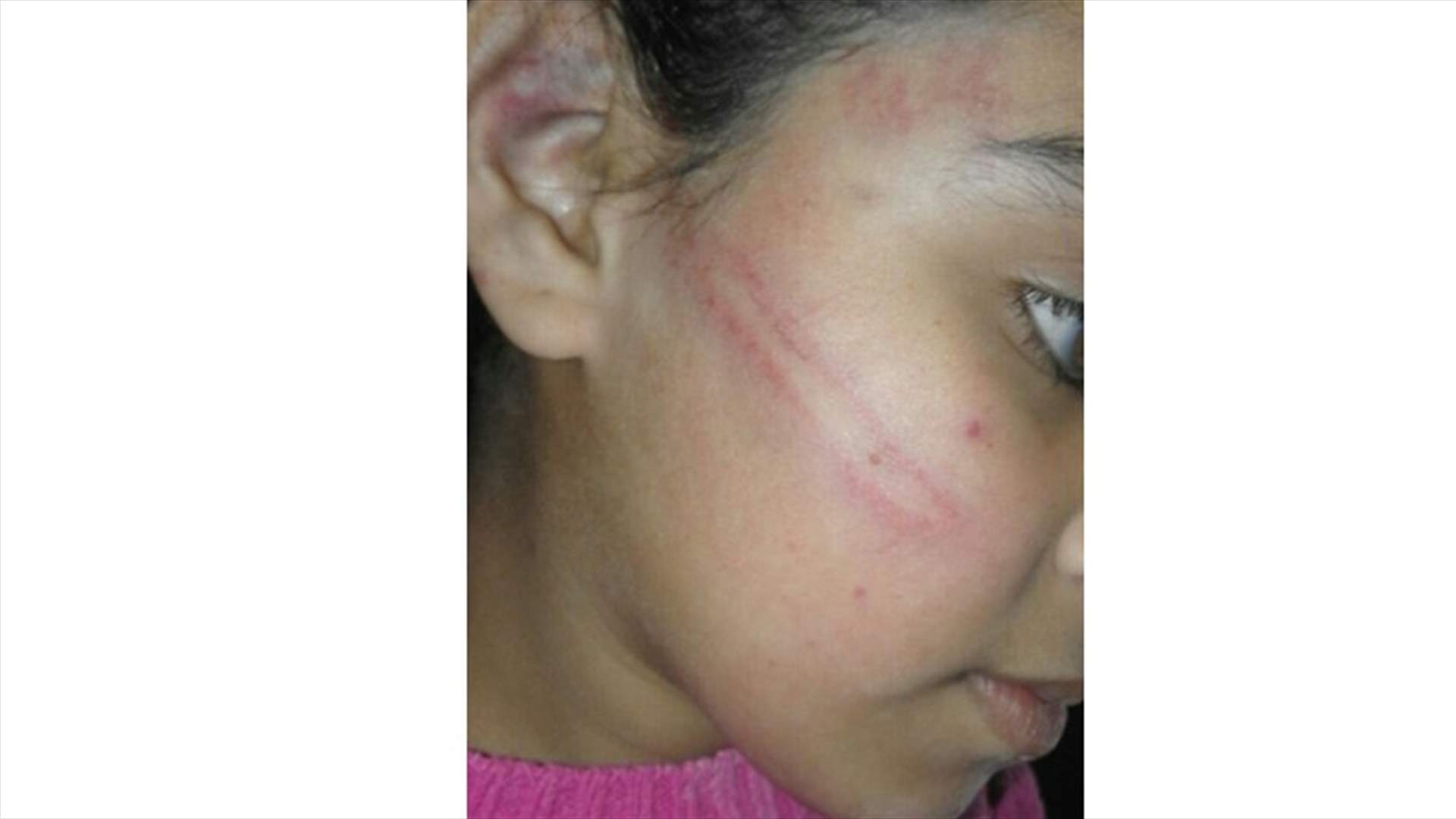 بعد ضربه طفلته بـ"النربيش"... توقيف الوالد في مخيم الرشيدية