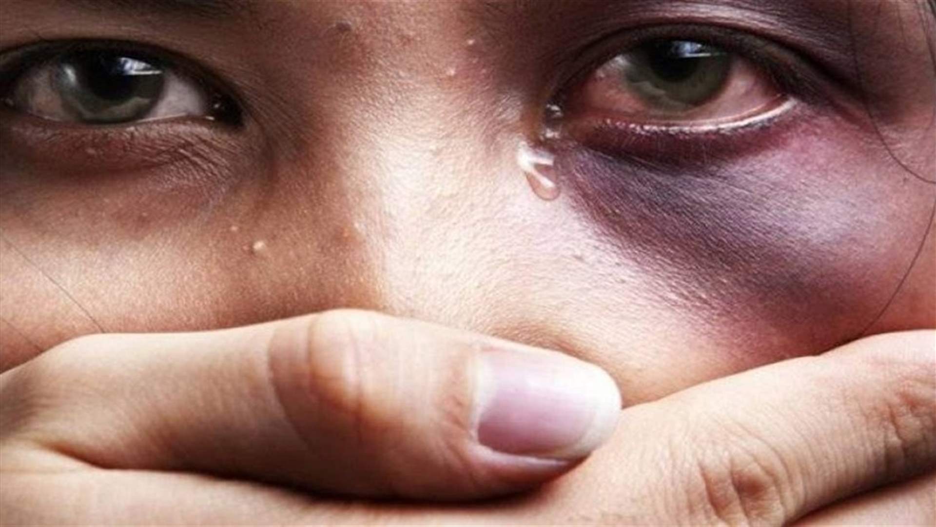 شوّه وجه زوجته وابتزها... لأنها رفضت شراء المخدرات له!