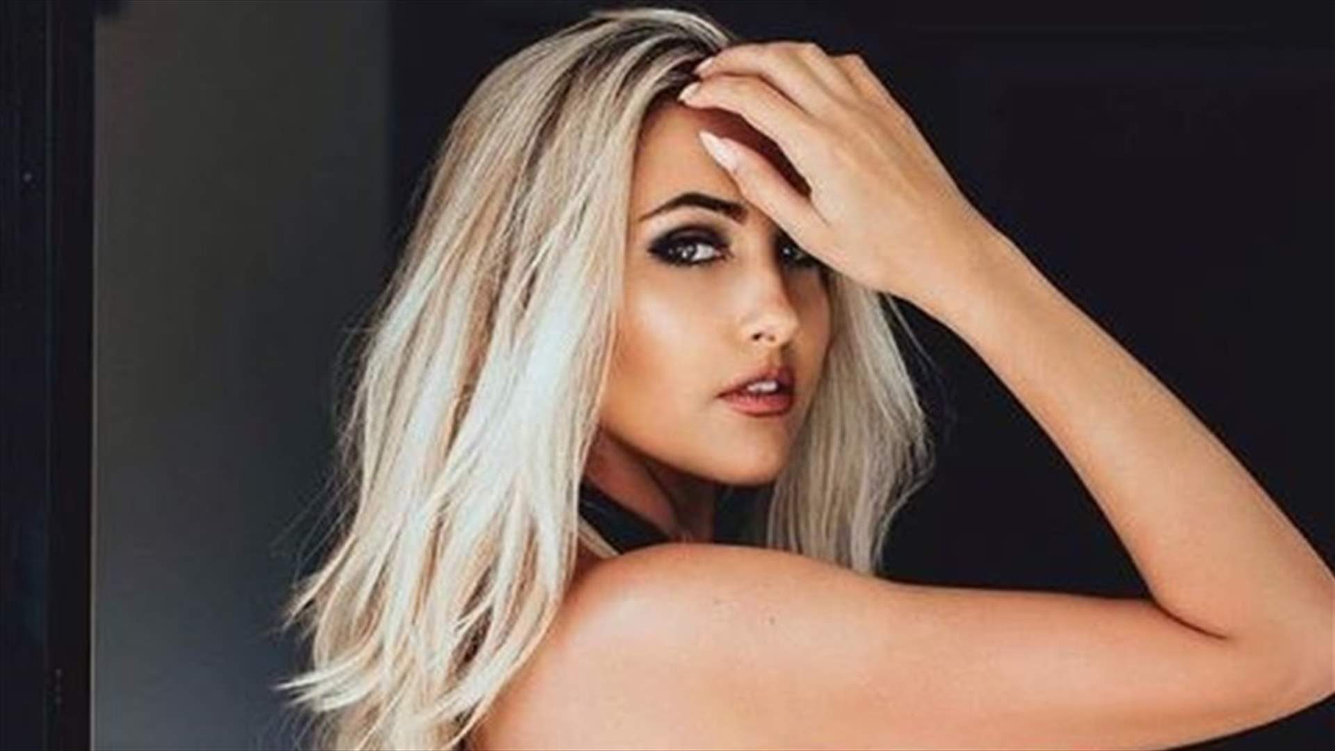بالصور - عارضة أزياء تعرّضت لتشوّه في وجهها بسبب عضّة كلب