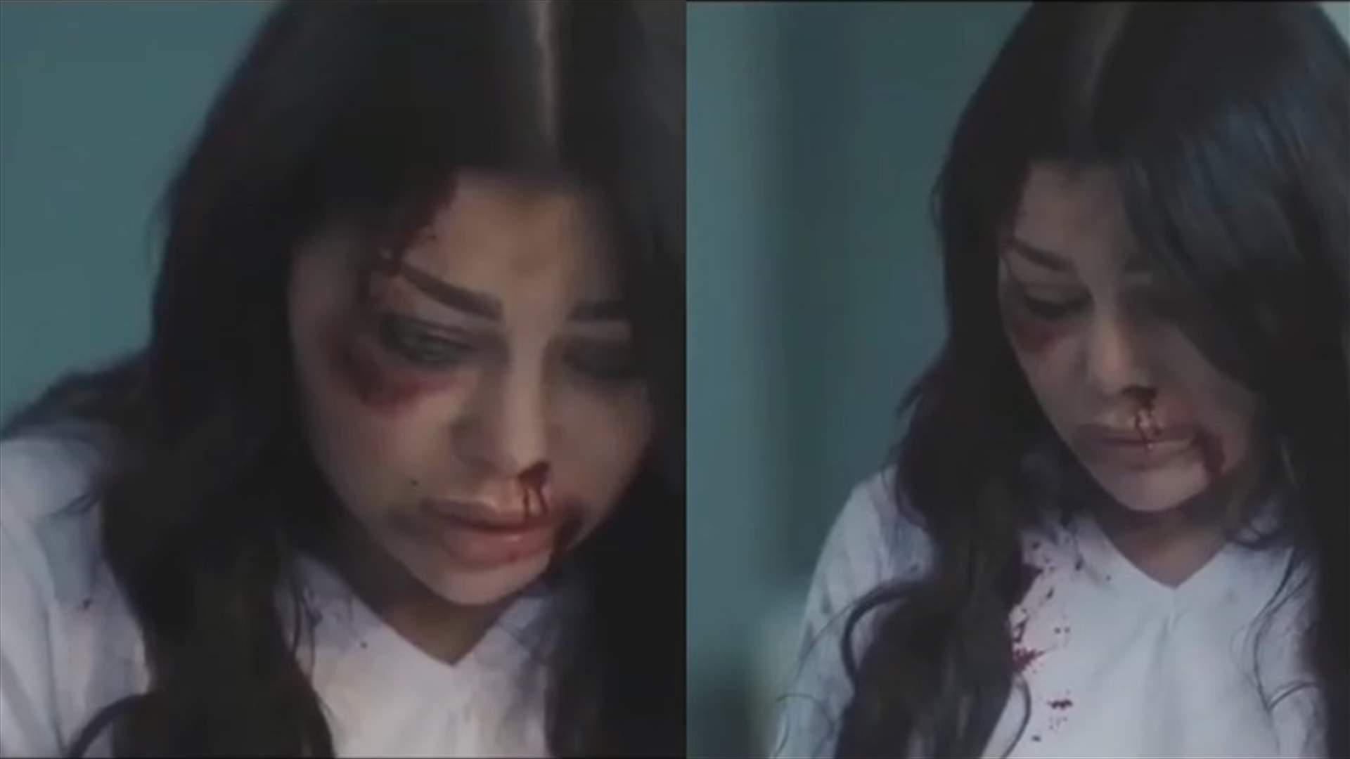 هيفا وهبي مضرّجة بالدماء وآثار الضرب على وجهها.. ما القصة؟