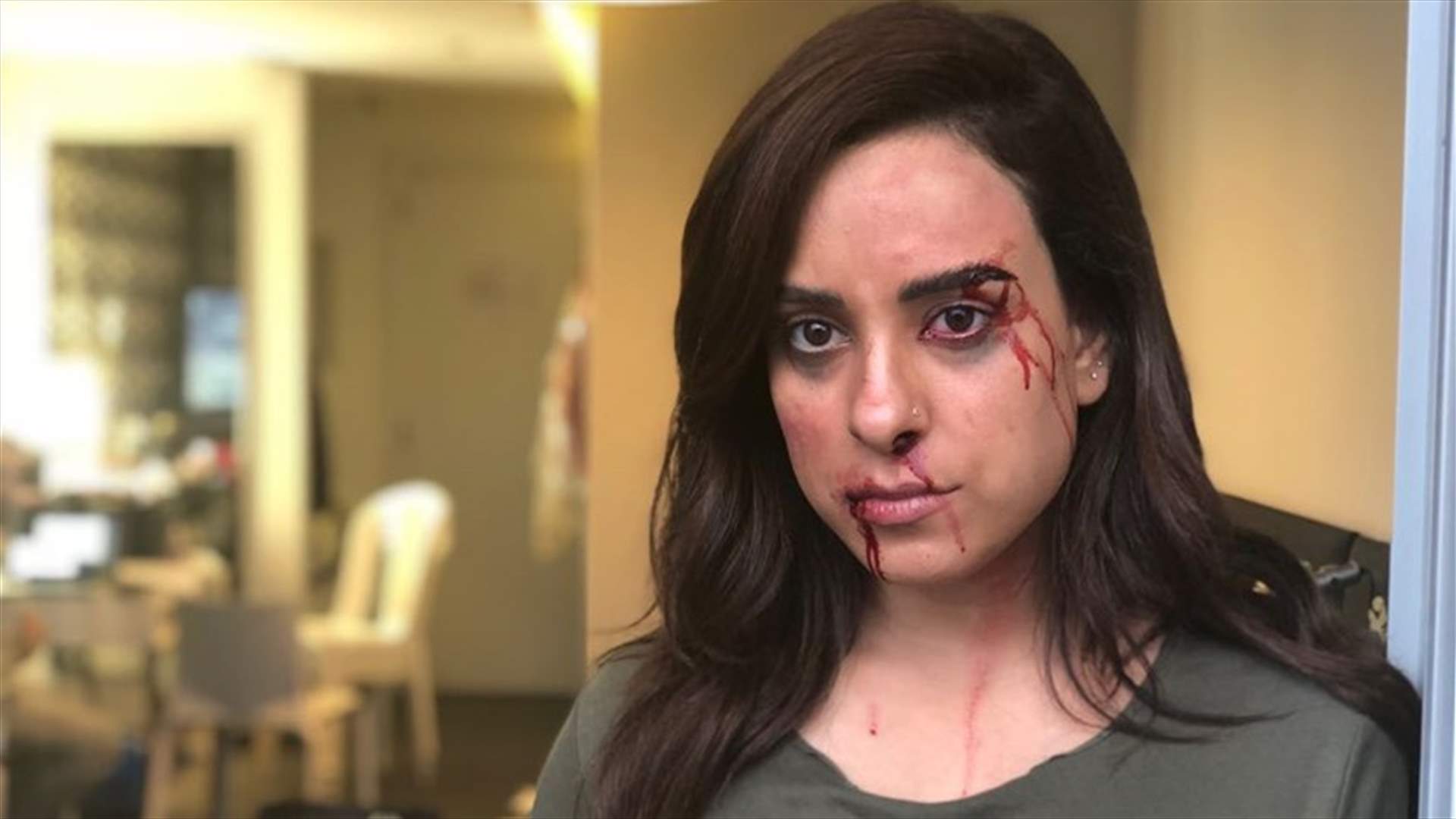 خاص- اندريه ناكوزي مضرّجة بالدماء.. فيديو من كواليس تعنيف كمال لليال