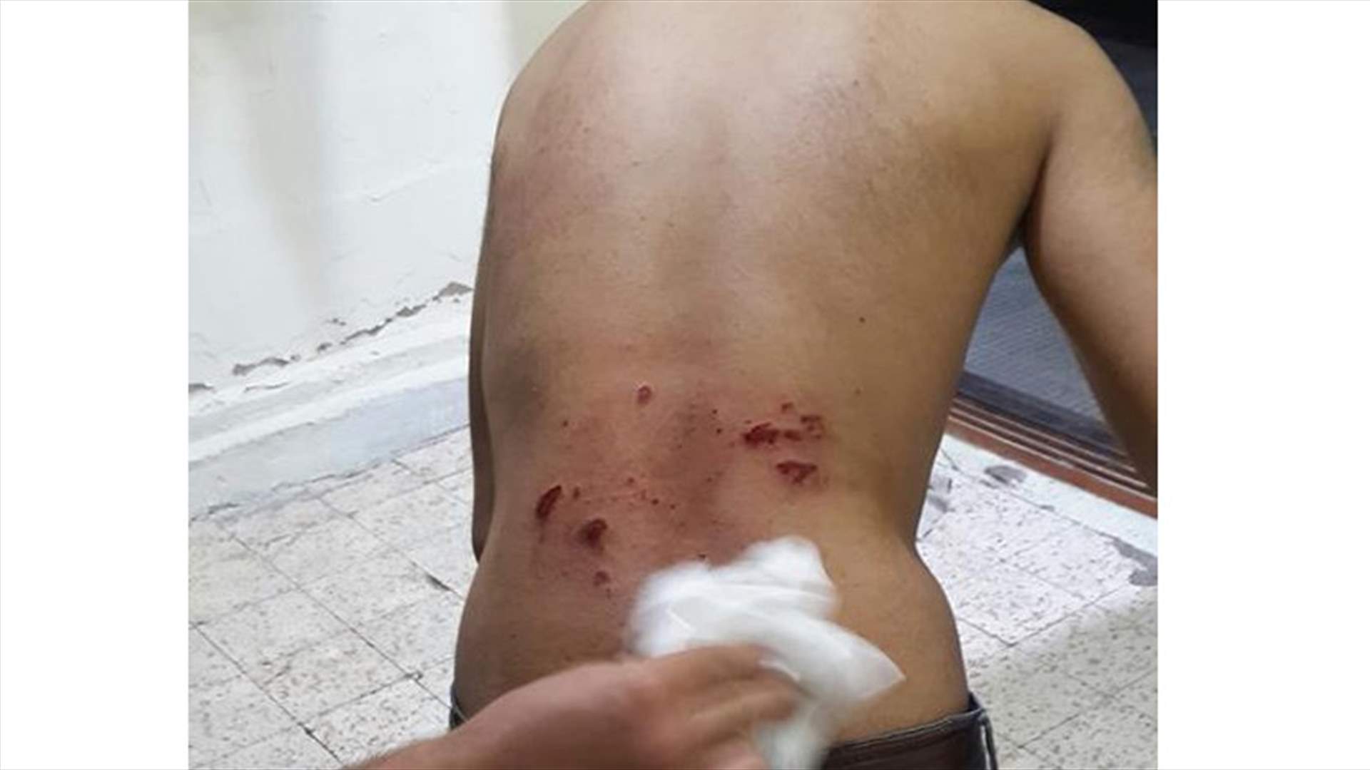 إشتباك ٌ بالسكاكين في طرابلس... وآخر بالأراكيل في المنية!