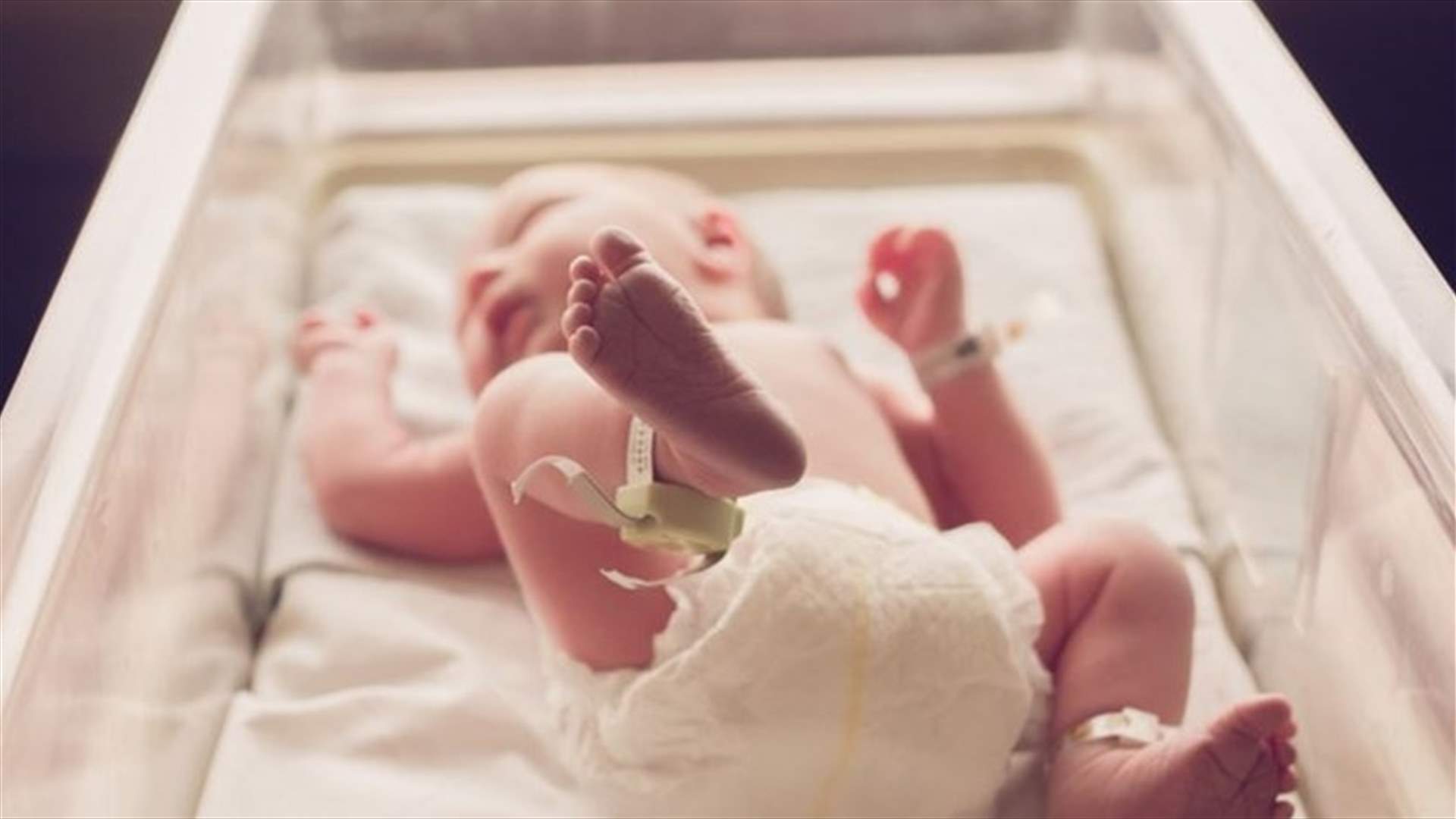 بالصور - حالة طبية نادرة... ولادة طفل بوجهين في رأس واحد