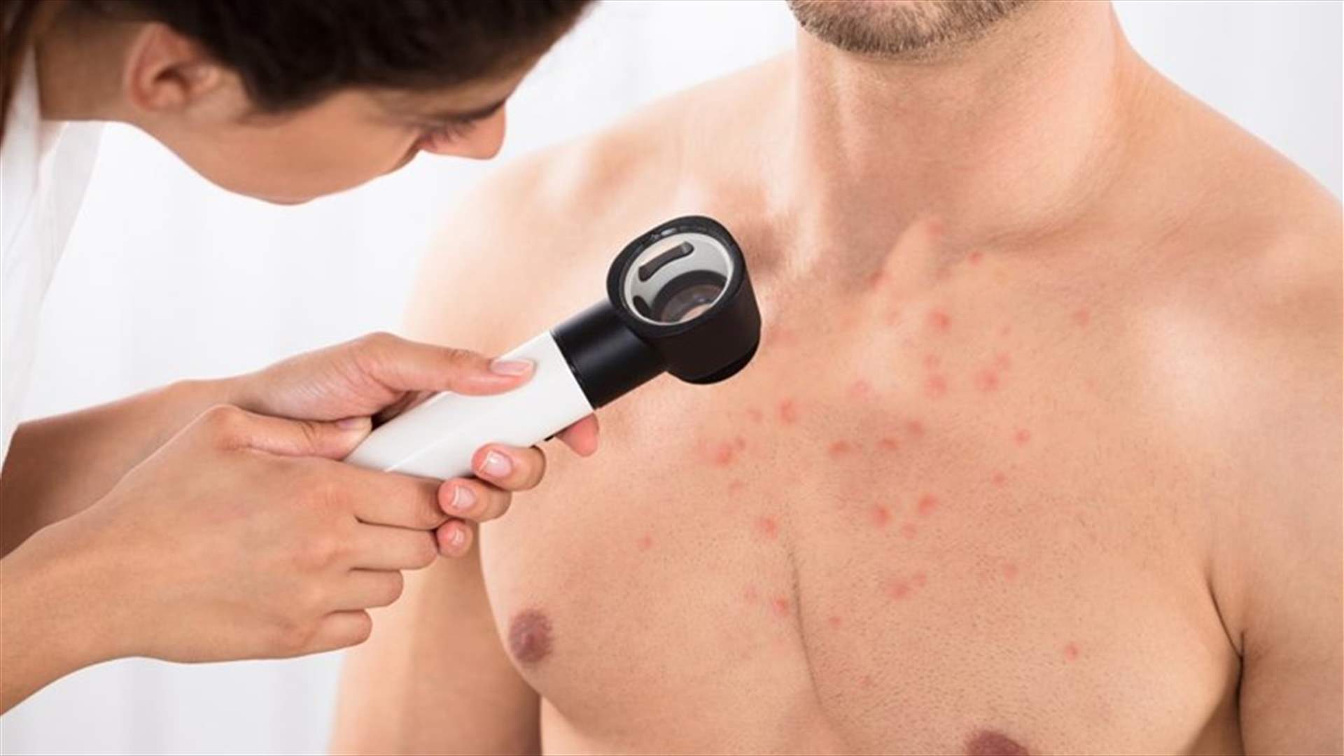 ما هي أسباب ظهور البثور على الثدي؟