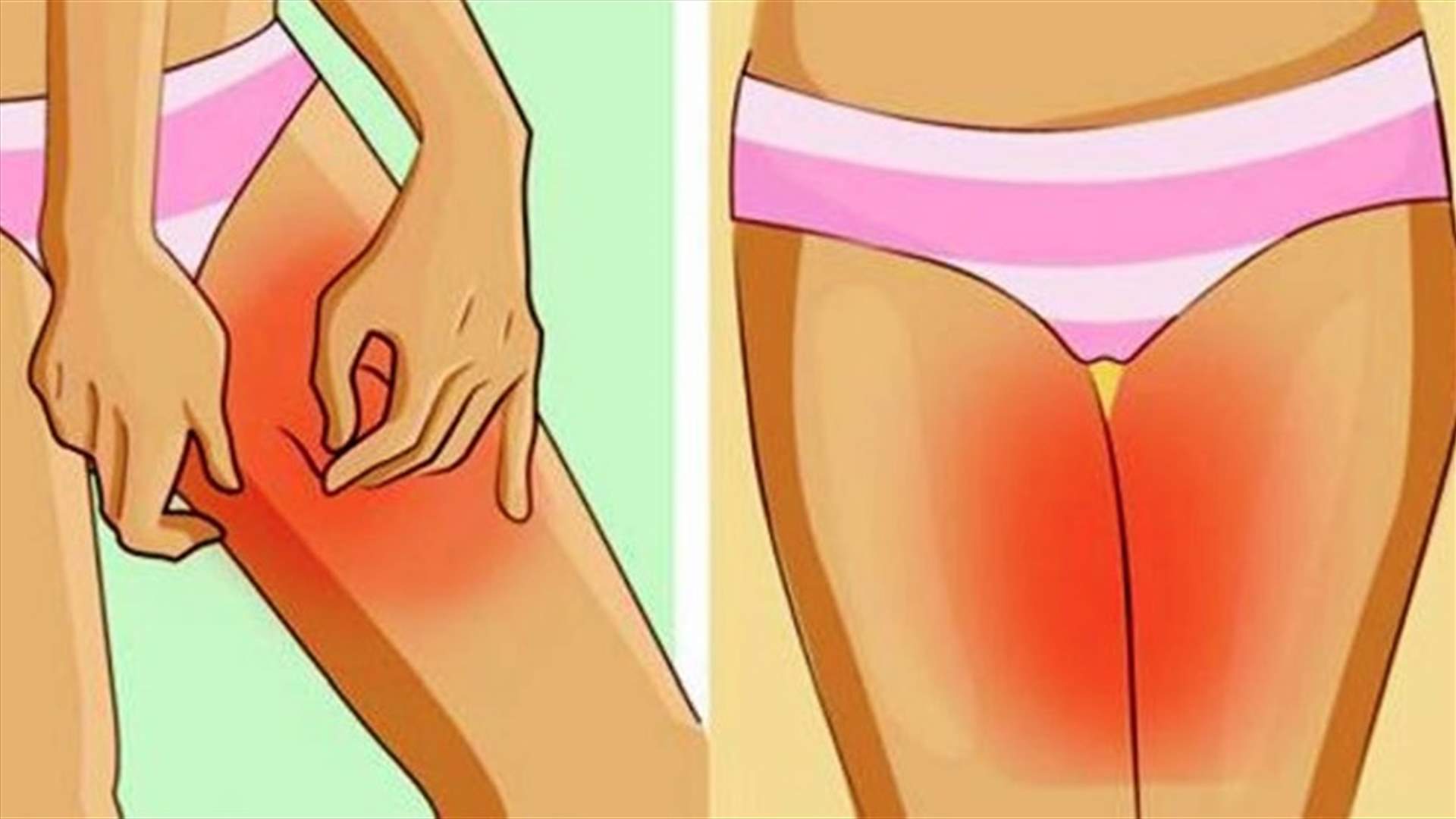 نصائح فعالة للحدّ من حساسيّة منطقة الفخذين