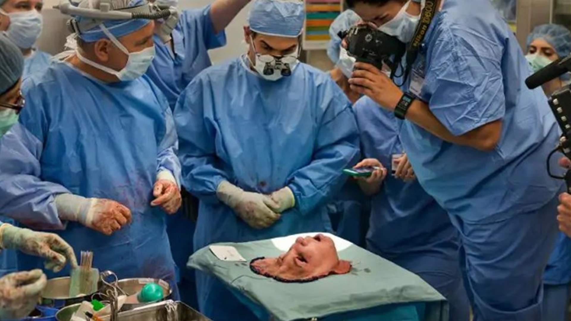 عملية زرع وجه تاريخية... فريق طبي بمشاركة طبيب لبناني ينقذ حياة فتاة في أوهايو