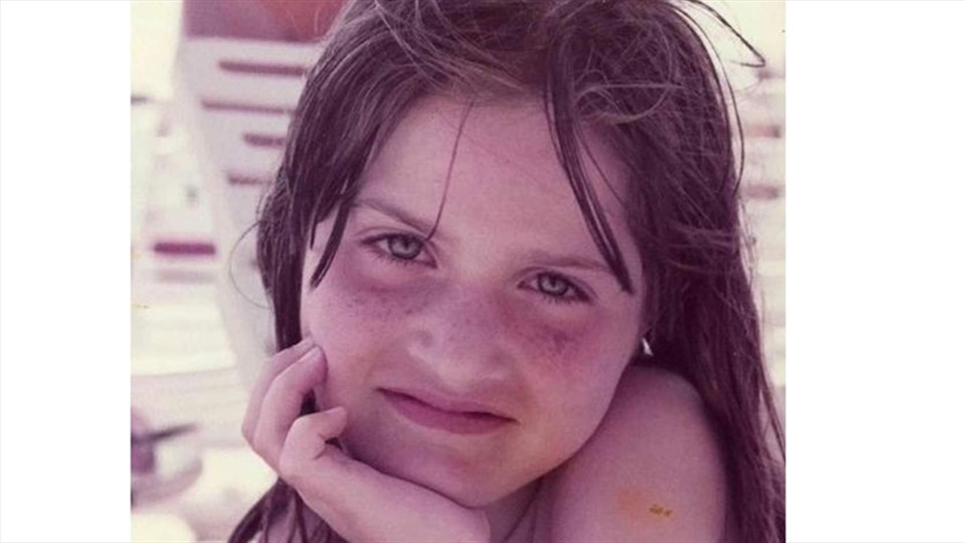 نجمة غناء وتمثيل يغطي النمش وجهها في طفولتها.. من هي؟