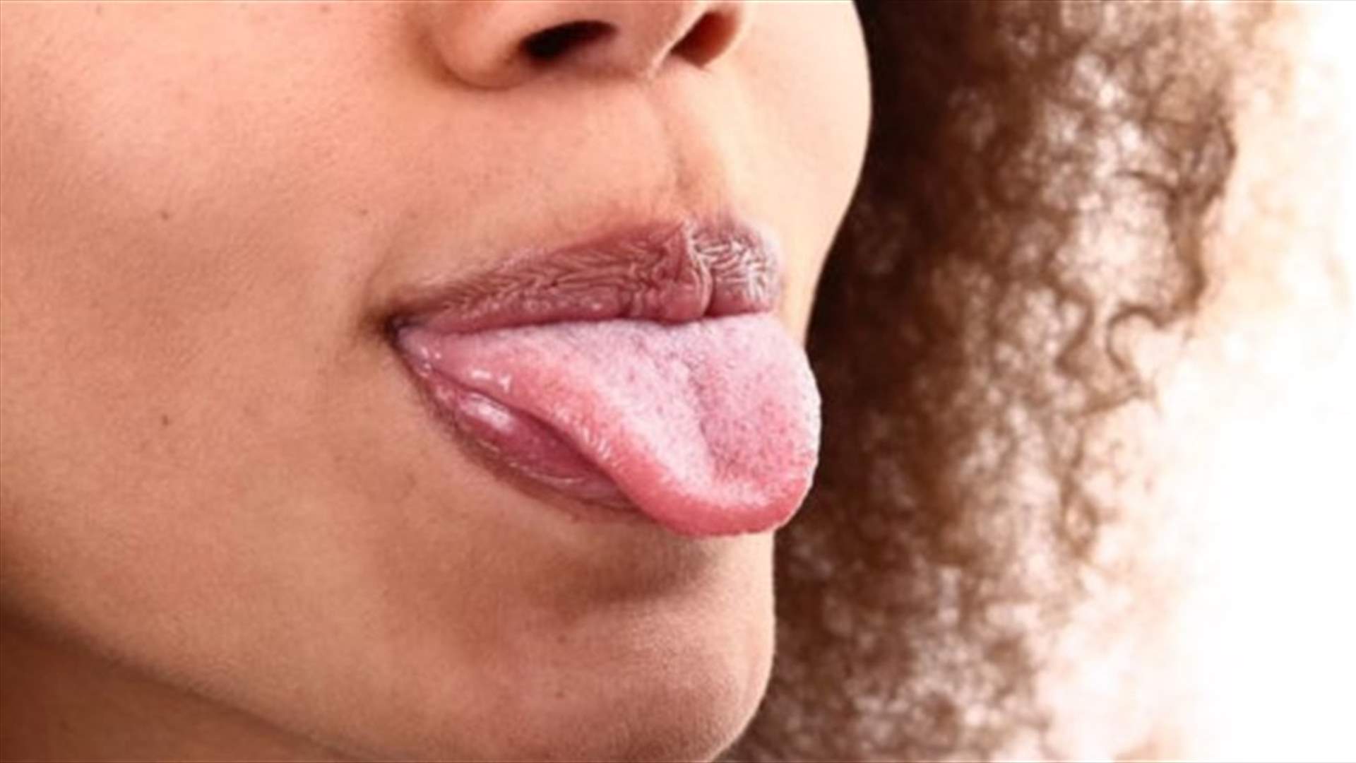 شعر أسود على اللسان...ما هذه الحالة الطبية؟