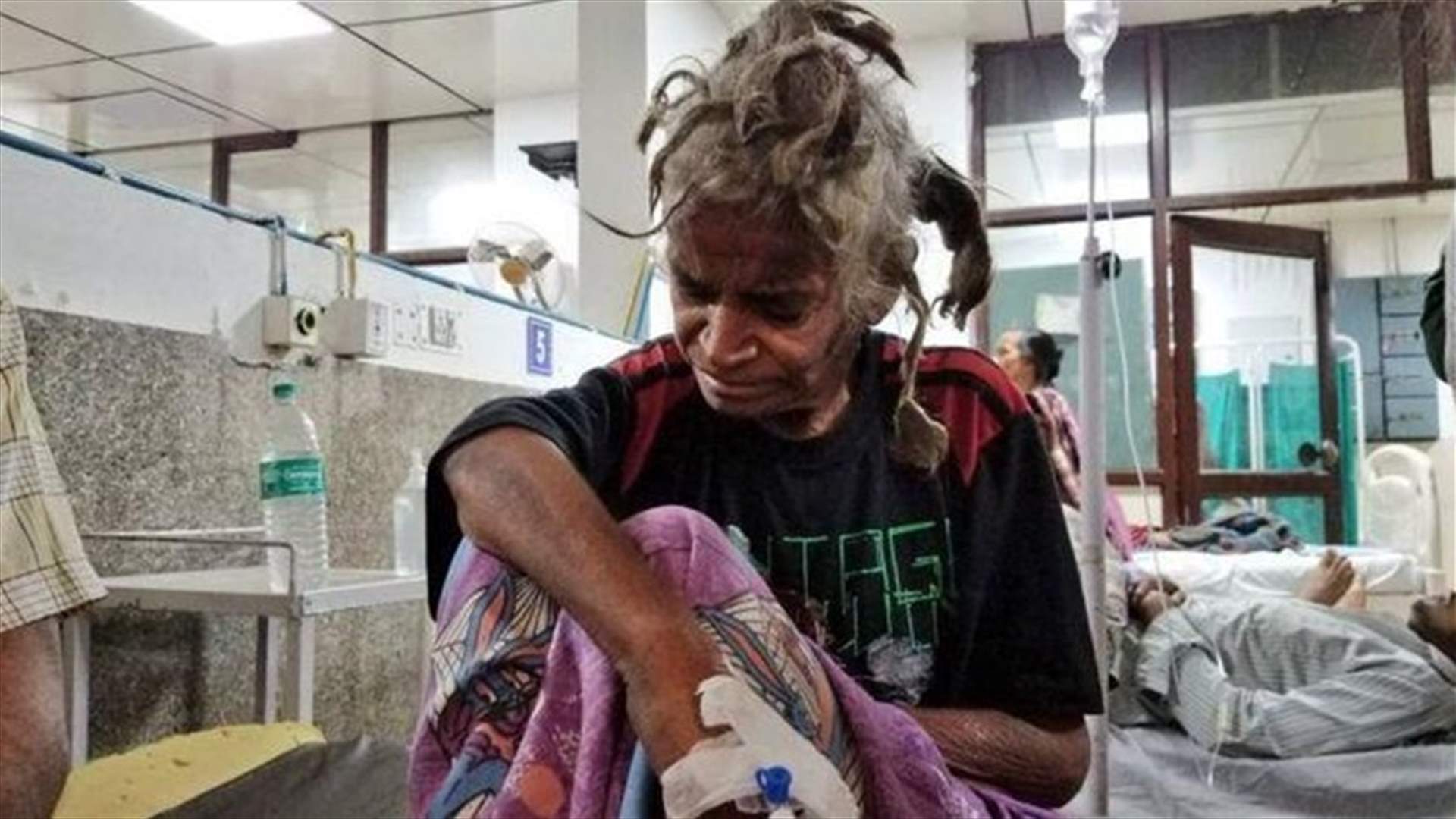 انقاذ امرأة حبسها شقيقها وعذّبها بوحشية لعامين... والصور صادمة