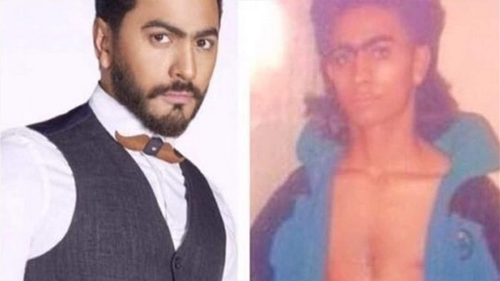 تامر حسني يردّ على منتقدي صورته الشهيرة في مرحلة المراهقة (فيديو)