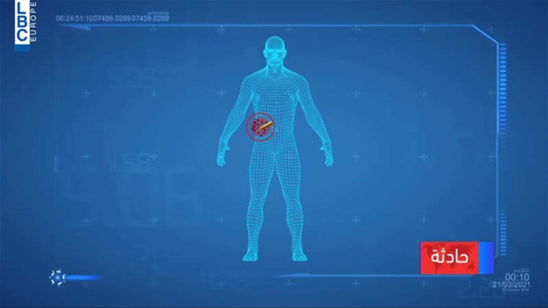 LBCI