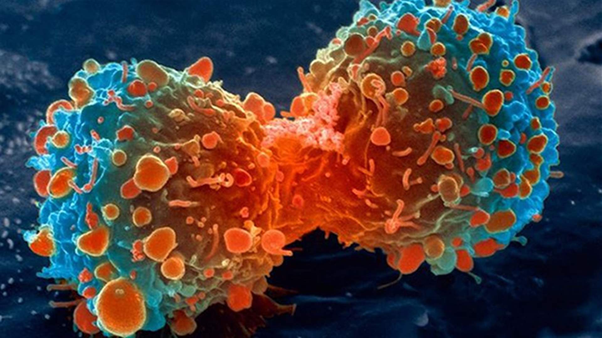 هل يساعد الصيام على محاربة مرض السرطان؟