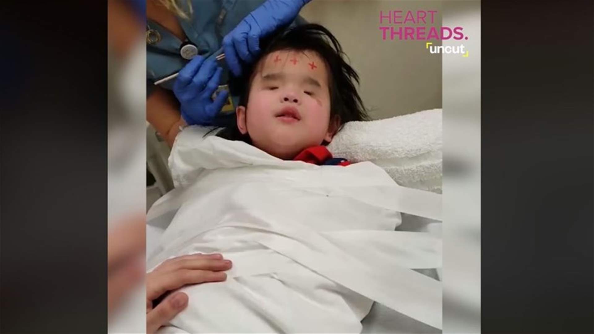 فيديو مؤثر لطفلة ضريرة تُغني أثناء علاجها لتهدئة نفسها (فيديو)