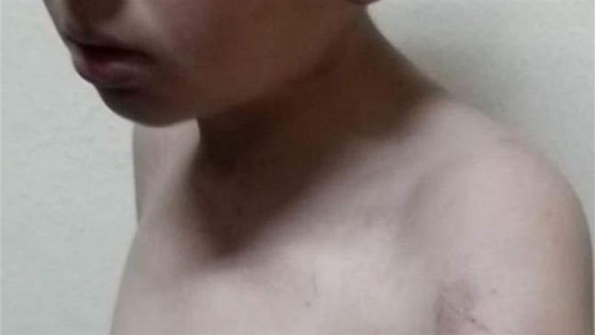 عنّف ابنه وتسبب له بحروق في جسده... (صور)