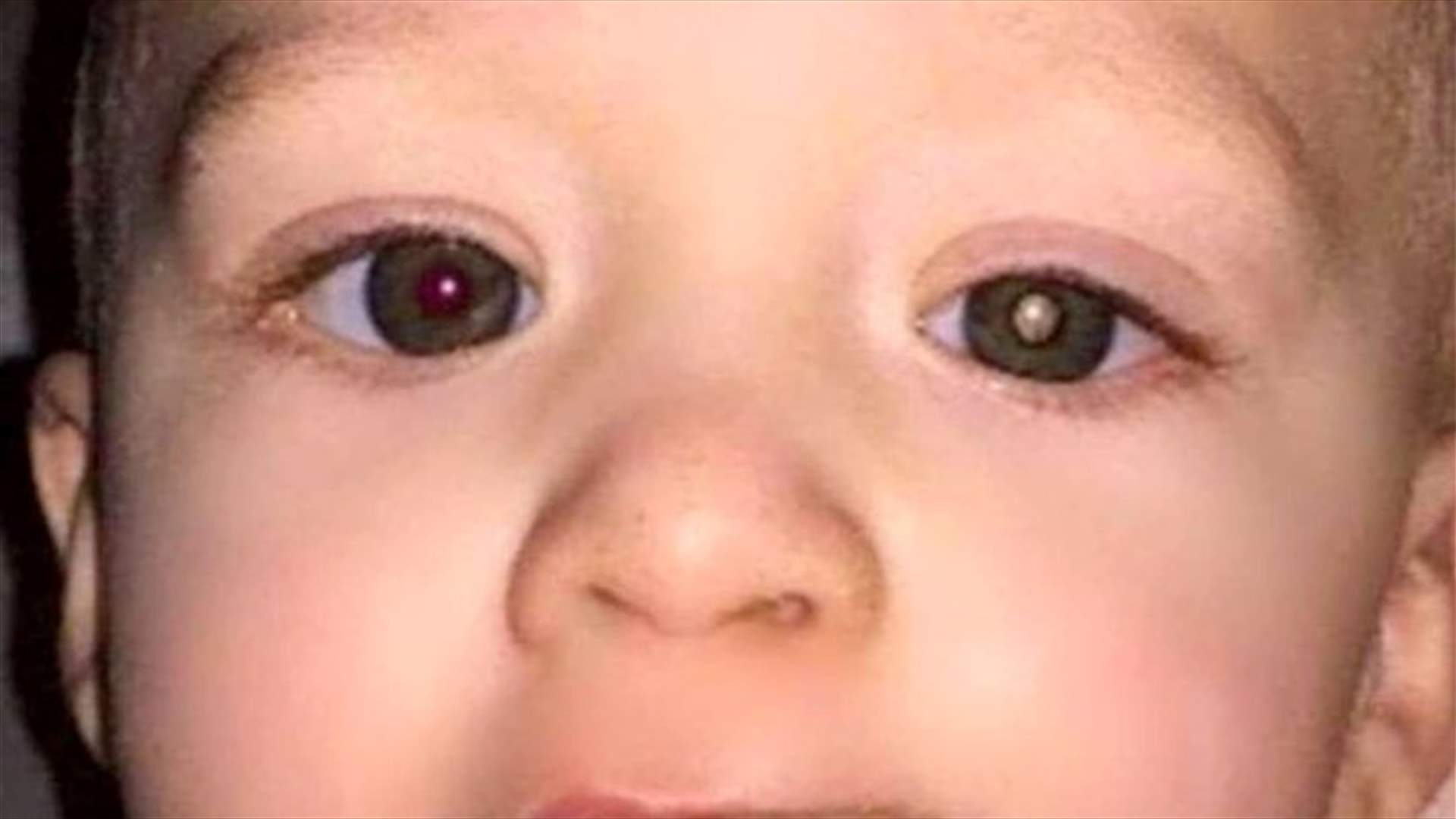 اكتشفت إصابة ابنها بسرطان العين... بفضل صورة التقطتها له