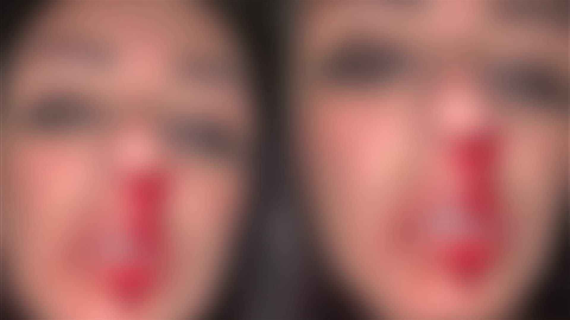 نجمة ستار أكاديمي تنشر صورها وهي تنزف: زوجي ضربني!