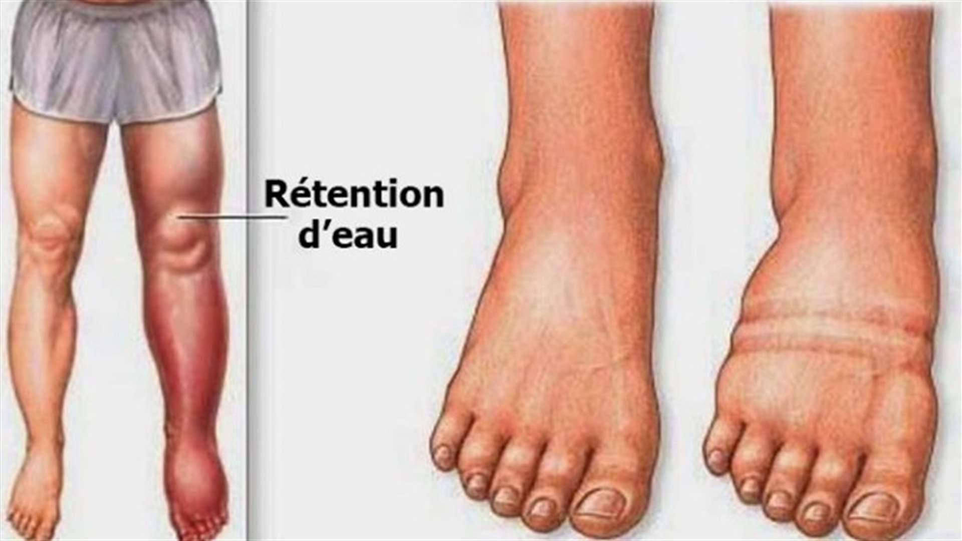 هذه الخطوات اليومية تساعدكم على التخلّص من مشكلة احتباس الماء