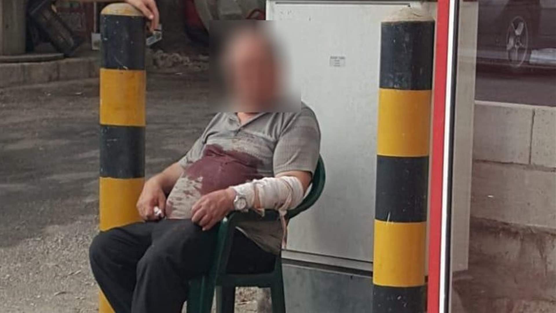 هاجمه أحد الموظفين لديه وطعنه في رومين... (صورة)