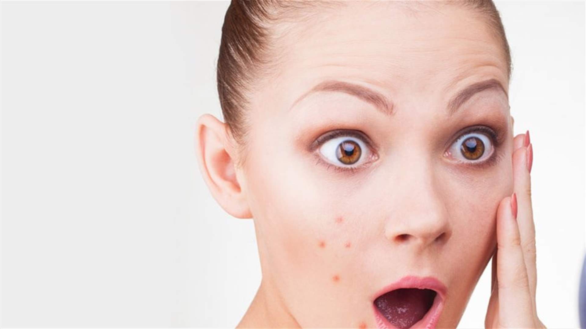 5 أمور عليكم تجنّبها إذا كنتم تُعانون من مشكلة حبّ الشباب